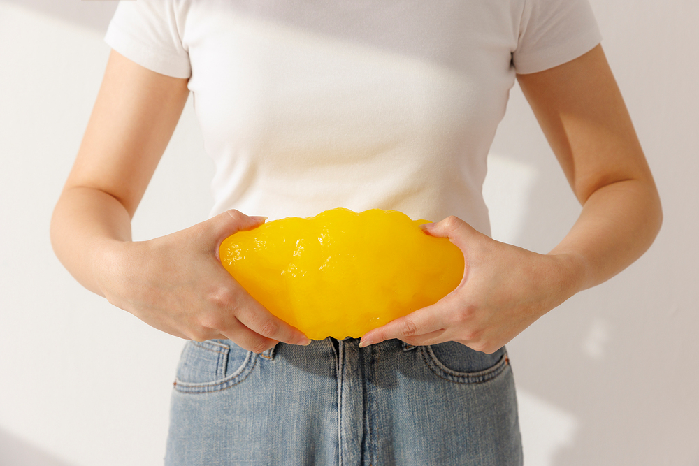¿Cuáles son algunas consideraciones importantes en relación con la cirugía de liposucción?