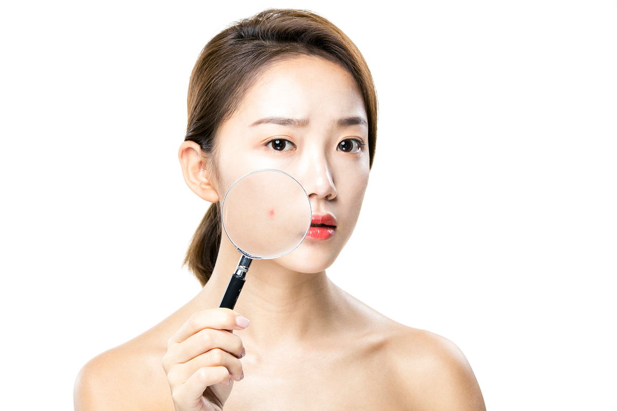 Phẫu thuật thẩm mỹ Hàn Quốc: Các phương pháp điều trị mụn trứng cá phổ biến.